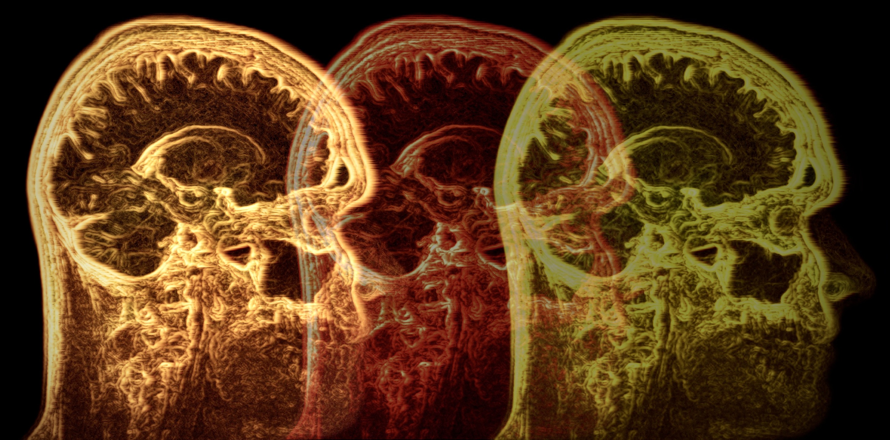 THALAMUS PROJECT live